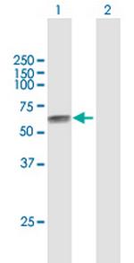 TPBG Antibody in Western Blot (WB)