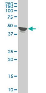 TPBG Antibody in Western Blot (WB)