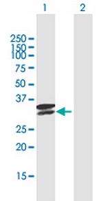 TPSAB1 Antibody in Western Blot (WB)