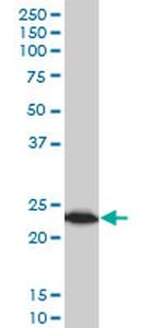 TPT1 Antibody in Western Blot (WB)