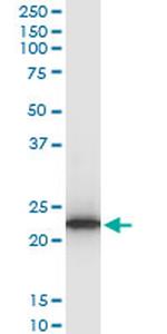 TPT1 Antibody in Western Blot (WB)