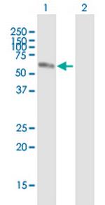 NR2C2 Antibody in Western Blot (WB)