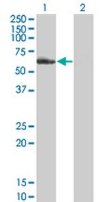 NR2C2 Antibody in Western Blot (WB)