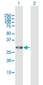 TRH Antibody in Western Blot (WB)