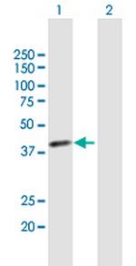 TSTA3 Antibody in Western Blot (WB)