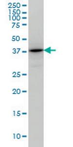 TSTA3 Antibody in Western Blot (WB)