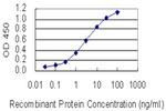 TTPA Antibody in ELISA (ELISA)