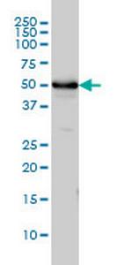 TUBA1 Antibody in Western Blot (WB)