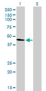 TUBA4A Antibody in Western Blot (WB)