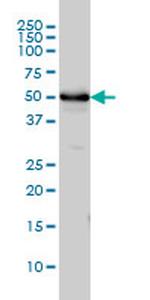 TUBA4A Antibody in Western Blot (WB)