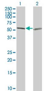 TUBA1 Antibody in Western Blot (WB)