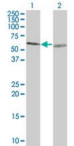 TUBA1 Antibody in Western Blot (WB)