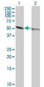 TUBA1 Antibody in Western Blot (WB)