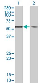 TUBA1 Antibody in Western Blot (WB)