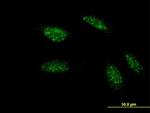 TWIST1 Antibody in Immunocytochemistry (ICC/IF)