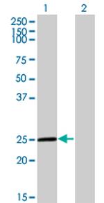 TWIST1 Antibody in Western Blot (WB)