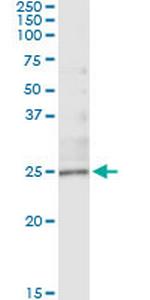 TWIST1 Antibody in Immunoprecipitation (IP)