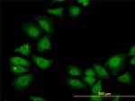 TXN Antibody in Immunocytochemistry (ICC/IF)