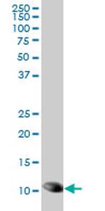 TXN Antibody in Western Blot (WB)