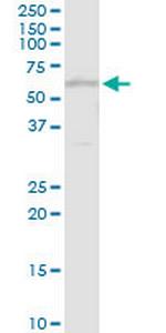 TXNRD1 Antibody in Western Blot (WB)