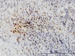 TYK2 Antibody in Immunohistochemistry (Paraffin) (IHC (P))