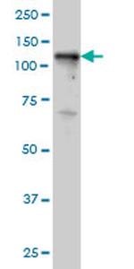 TYK2 Antibody in Western Blot (WB)