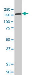 TYK2 Antibody in Western Blot (WB)