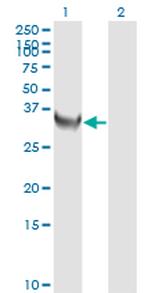 TYMS Antibody in Western Blot (WB)