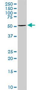 TYR Antibody in Western Blot (WB)