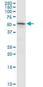 TYRP1 Antibody in Western Blot (WB)