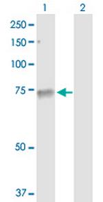 TYRP1 Antibody in Western Blot (WB)