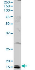 UBE2B Antibody in Western Blot (WB)