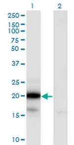 UBE2G2 Antibody in Western Blot (WB)