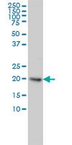 UBE2H Antibody in Western Blot (WB)