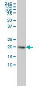 UBE2H Antibody in Western Blot (WB)