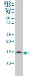 UBE2N Antibody in Western Blot (WB)