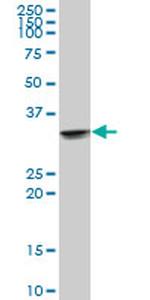 UCP2 Antibody in Western Blot (WB)