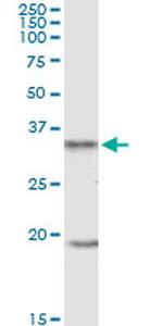 UCP2 Antibody in Western Blot (WB)