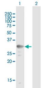 UCP2 Antibody in Western Blot (WB)