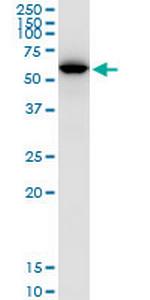 UGDH Antibody in Western Blot (WB)