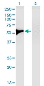 UGDH Antibody in Western Blot (WB)