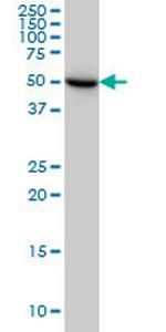 UGP2 Antibody in Western Blot (WB)