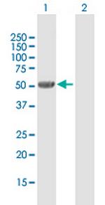 UGT2B7 Antibody in Western Blot (WB)