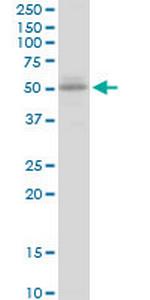 UGT2B15 Antibody in Western Blot (WB)