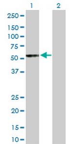 UGT2B15 Antibody in Western Blot (WB)