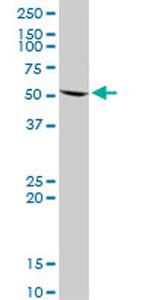 UMPS Antibody in Western Blot (WB)