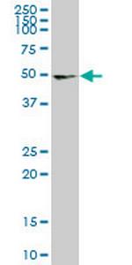 UMPS Antibody in Western Blot (WB)