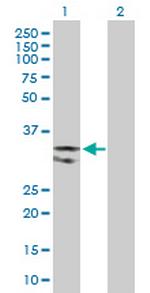 UNG Antibody in Western Blot (WB)