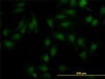 NR1H2 Antibody in Immunocytochemistry (ICC/IF)