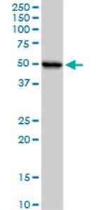 UQCRC1 Antibody in Western Blot (WB)